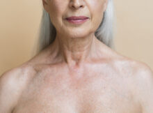 ¿Por qué el cuello envejece más rápido?